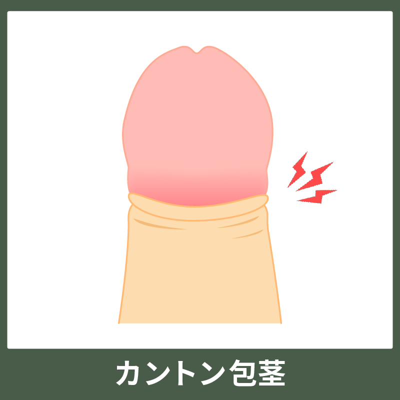 10代向け | 包茎と男性器の洗い方！