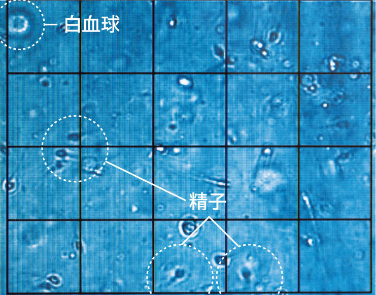 精子戦争 性行動の謎を解く ロビン・ベイカー