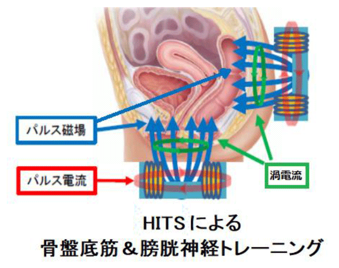 前立腺がんの余命」はご存知ですか？ステージ別の余命・生存率も医師が解説！ | メディカルドック