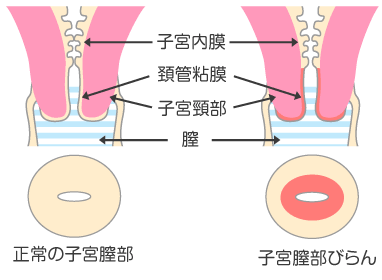 栄誉の名器 橋本ありな - オナホ通販｜大人のおもちゃ通販大魔王