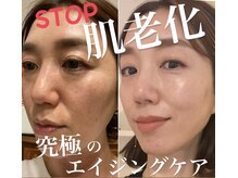 アクビ(aku美)』体験談。北海道白石のエロエロだが若干OPIが残念…。 | 全国のメンズエステ体験談・口コミなら投稿情報サイト 男のお得情報局